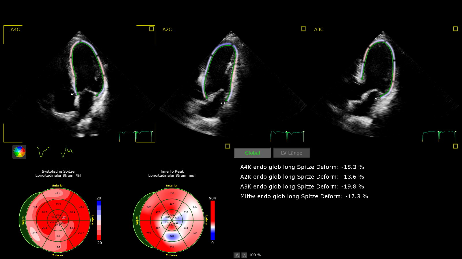 Farb-Doppler-Echokardiographie (Herz-Ultraschall)